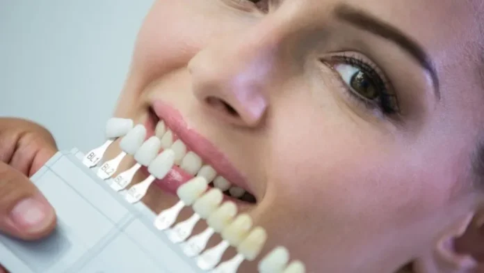 Bevor Sie Veneers bekommen